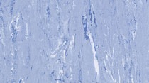 Mipolam Troplan 1036 MEDIUM BLUE фото 1 | FLOORDEALER